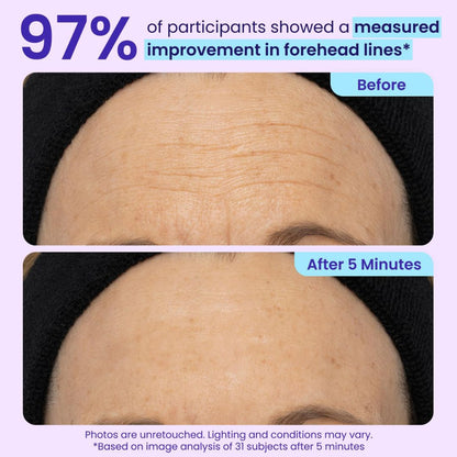 BrightLook™ Collagen Eye Care