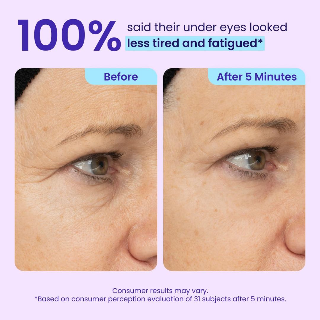 BrightLook™ Collagen Eye Care